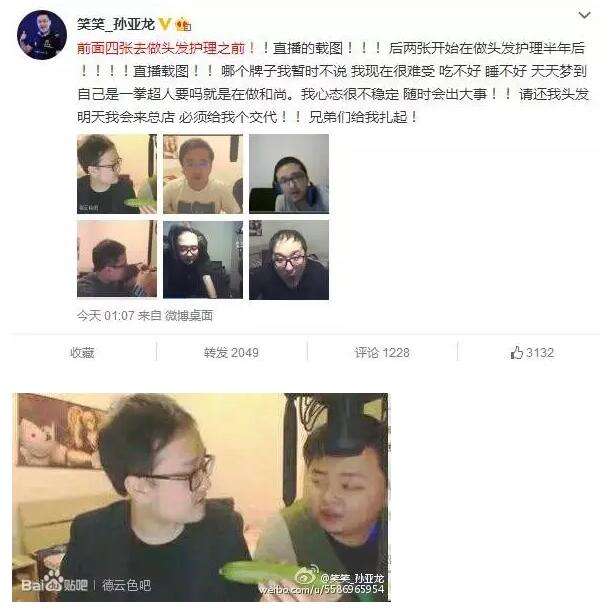 lol笑笑:花6万植头发 然而头发却越来越少