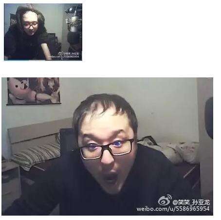 lol笑笑:花6万植头发 然而头发却越来越少