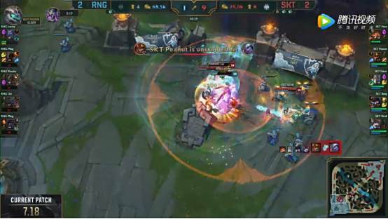 英雄联盟记忆收录机